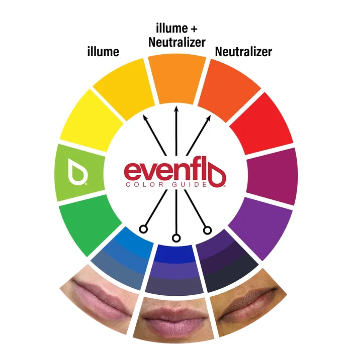 Evenflo Anal Evenflo Neutralizer Set 3 12oz Bottles